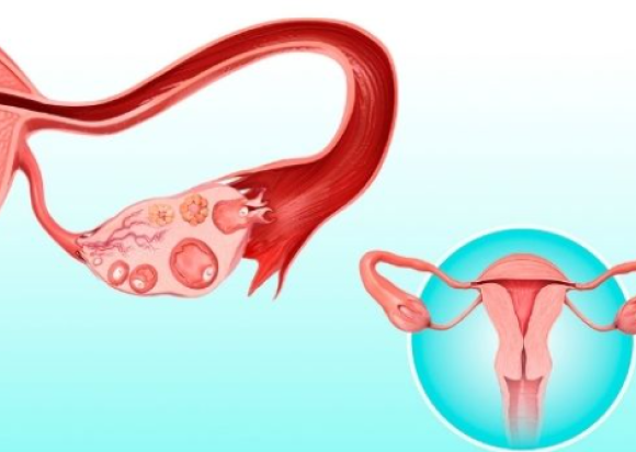 First Trimester Screening (FTS/EFTS)